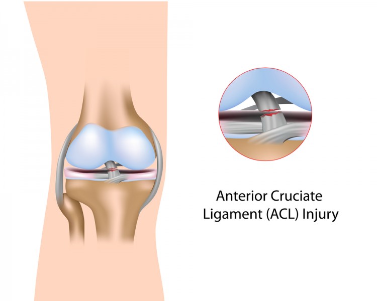 Ligament Surgery Hospital, Pimple Saudagar